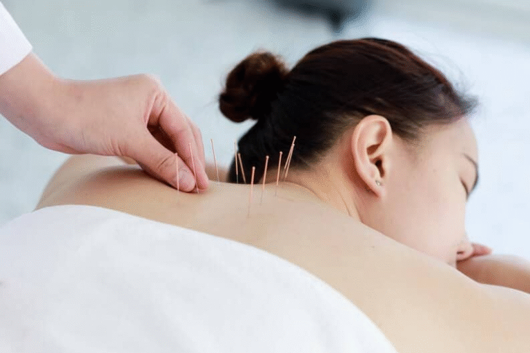 Acupuncture Visit